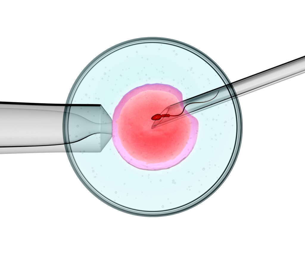 Fécondation in vitro